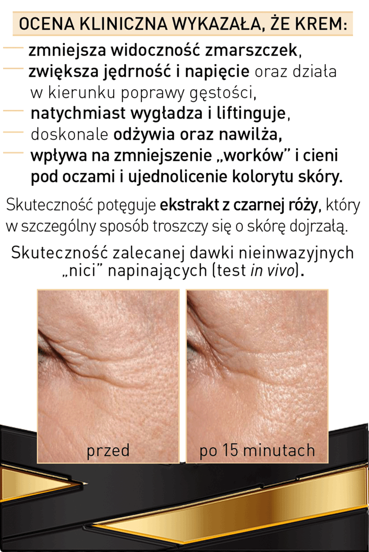 Janda Si A Nici Kosmetycznych Forte Krem Pod Oczy Redukuj Cy