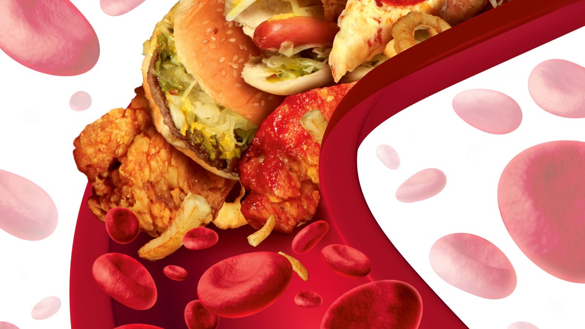 Cholesterol na poziomie: na co i kiedy trzeba uważać?