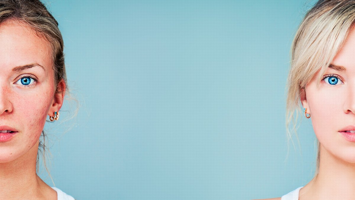 header